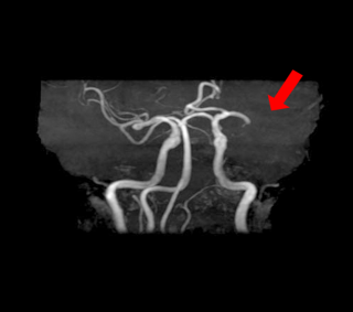 MRI・MRA検査