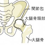 大腿骨頸部骨折